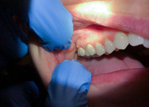 Best Same-Day Emergency Dental Services in Lazy Mountain, AK